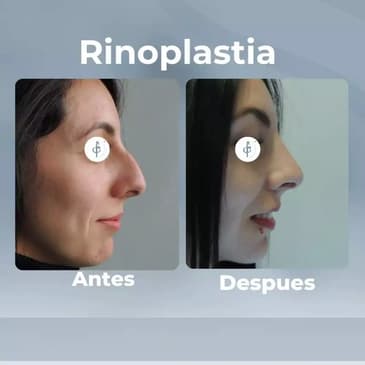 Slider image (6) Dr. Felipe Castro Esguerra - Plastic Surgeon in Colombia